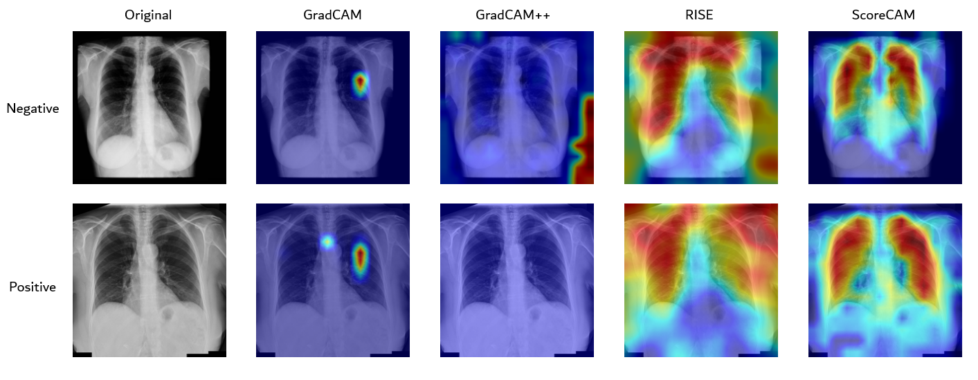 Explanations generated by the used XAI techniques